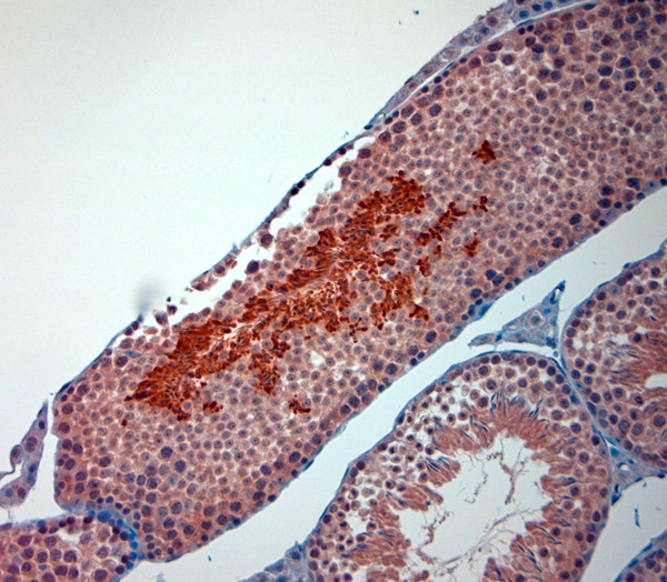 TRPM8 Antibody in Immunohistochemistry (Paraffin) (IHC (P))