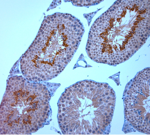 TRPM8 Antibody in Immunohistochemistry (Paraffin) (IHC (P))