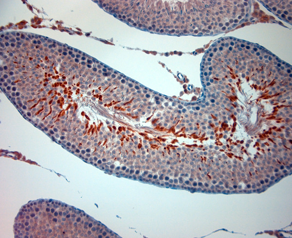 TRPM8 Antibody in Immunohistochemistry (Paraffin) (IHC (P))