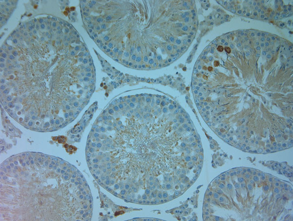 TRPV4 Antibody in Immunohistochemistry (Paraffin) (IHC (P))