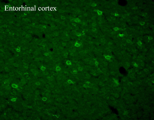 TRPC3 Antibody in Immunohistochemistry (Frozen) (IHC (F))