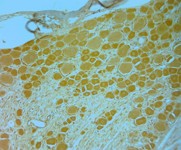 TrkB Antibody in Immunohistochemistry (Paraffin) (IHC (P))