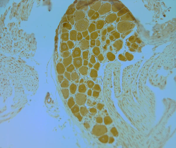 TrkB Antibody in Immunohistochemistry (Paraffin) (IHC (P))