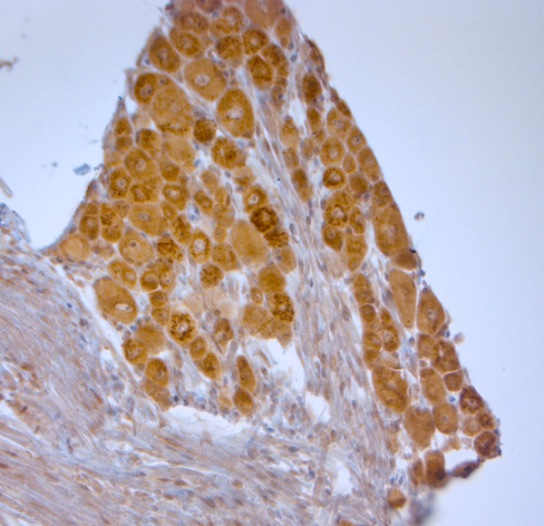 TGN38 Antibody in Immunohistochemistry (Paraffin) (IHC (P))