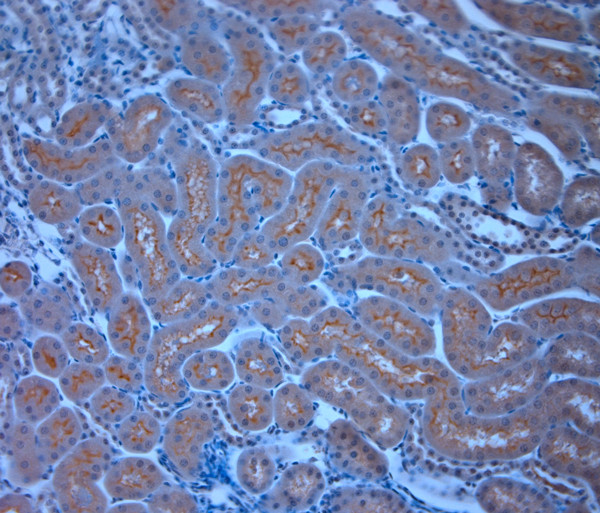 TRPM6 Antibody in Immunohistochemistry (Paraffin) (IHC (P))