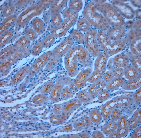 TRPM6 Antibody in Immunohistochemistry (Paraffin) (IHC (P))