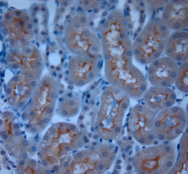 TRPM6 Antibody in Immunohistochemistry (Paraffin) (IHC (P))