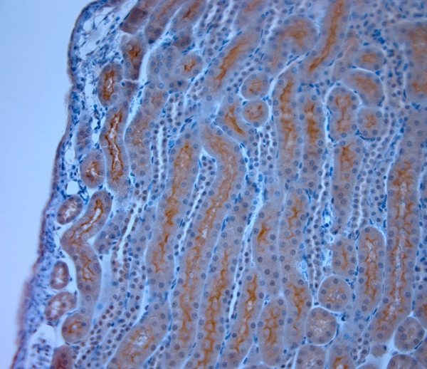 TRPM6 Antibody in Immunohistochemistry (Paraffin) (IHC (P))