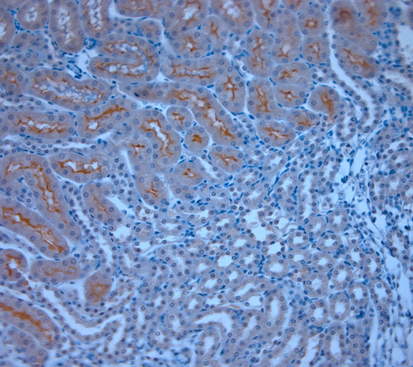 TRPM6 Antibody in Immunohistochemistry (Paraffin) (IHC (P))