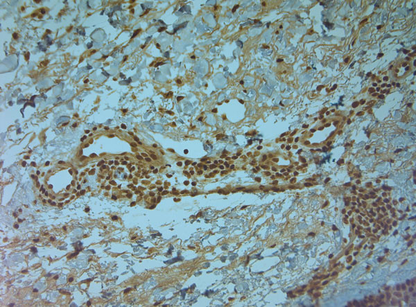 TPC1 Antibody in Immunohistochemistry (Paraffin) (IHC (P))