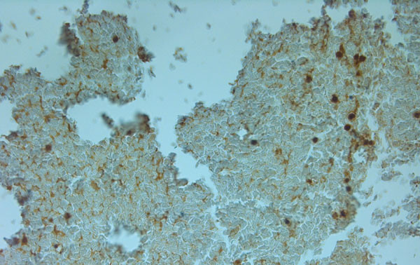 TPC1 Antibody in Immunohistochemistry (Paraffin) (IHC (P))