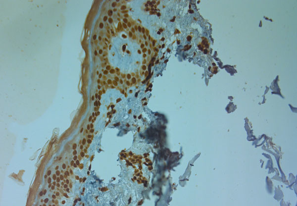 TPC1 Antibody in Immunohistochemistry (Paraffin) (IHC (P))