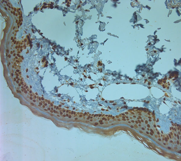 TPC1 Antibody in Immunohistochemistry (Paraffin) (IHC (P))