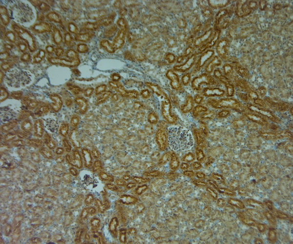 TPC1 Antibody in Immunohistochemistry (Paraffin) (IHC (P))