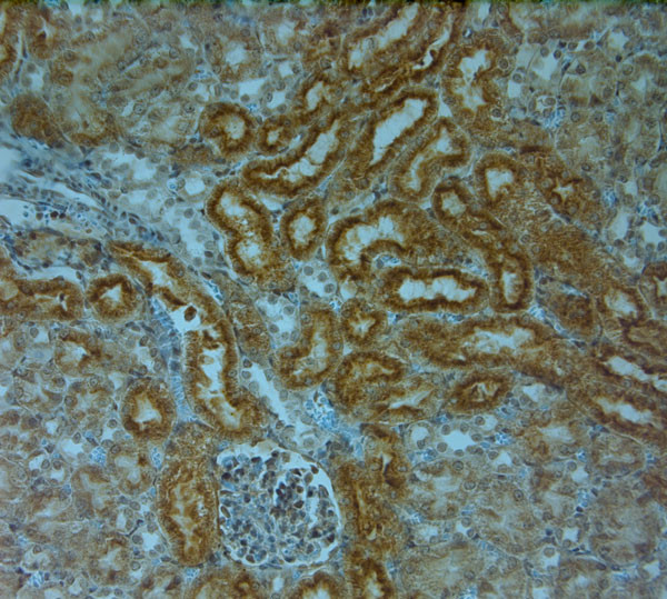 TPC1 Antibody in Immunohistochemistry (Paraffin) (IHC (P))