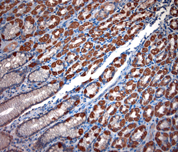 TPC2 Antibody in Immunohistochemistry (Paraffin) (IHC (P))