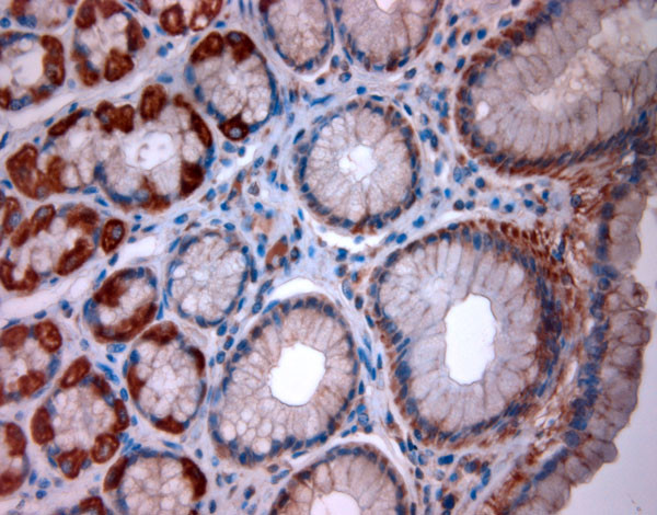 TPC2 Antibody in Immunohistochemistry (Paraffin) (IHC (P))