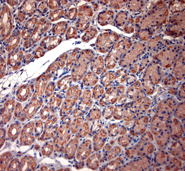 TPC2 Antibody in Immunohistochemistry (Paraffin) (IHC (P))