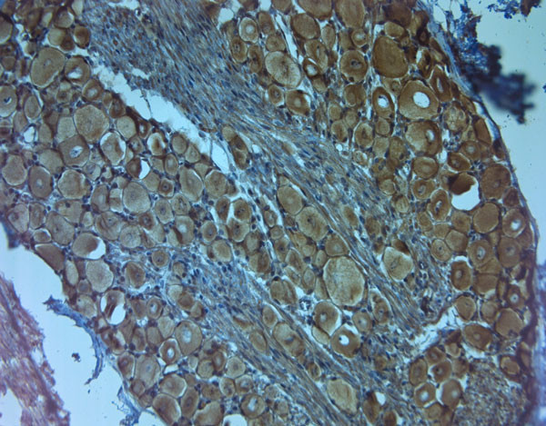 TrkC Antibody in Immunohistochemistry (Paraffin) (IHC (P))