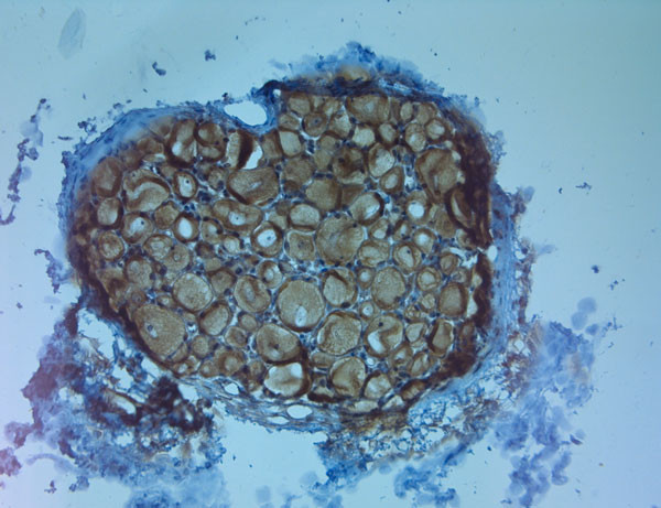 TrkC Antibody in Immunohistochemistry (Paraffin) (IHC (P))