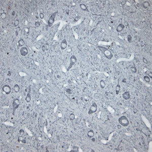 beta Tubulin Antibody in Immunohistochemistry (Paraffin) (IHC (P))