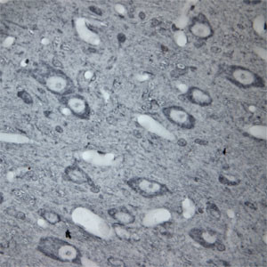 beta Tubulin Antibody in Immunohistochemistry (Paraffin) (IHC (P))