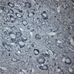 beta Tubulin Antibody in Immunohistochemistry (Paraffin) (IHC (P))