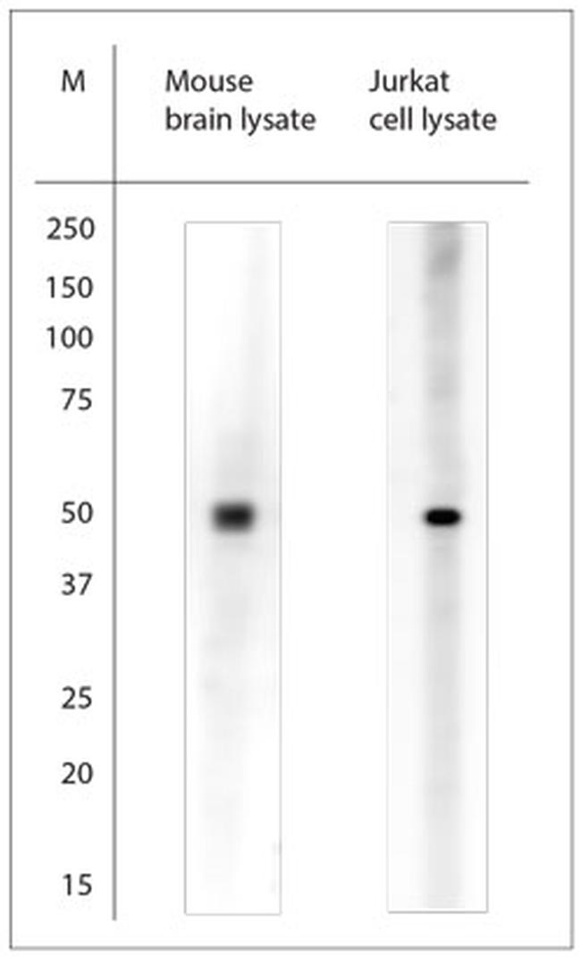 beta Tubulin Antibody in Western Blot (WB)