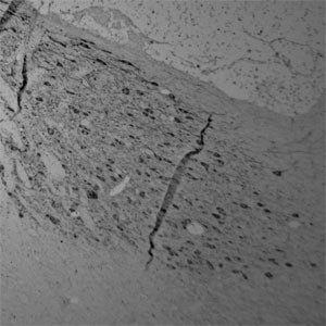 Tyrosine Hydroxylase Antibody in Immunohistochemistry (Paraffin) (IHC (P))