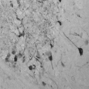 Tyrosine Hydroxylase Antibody in Immunohistochemistry (Paraffin) (IHC (P))