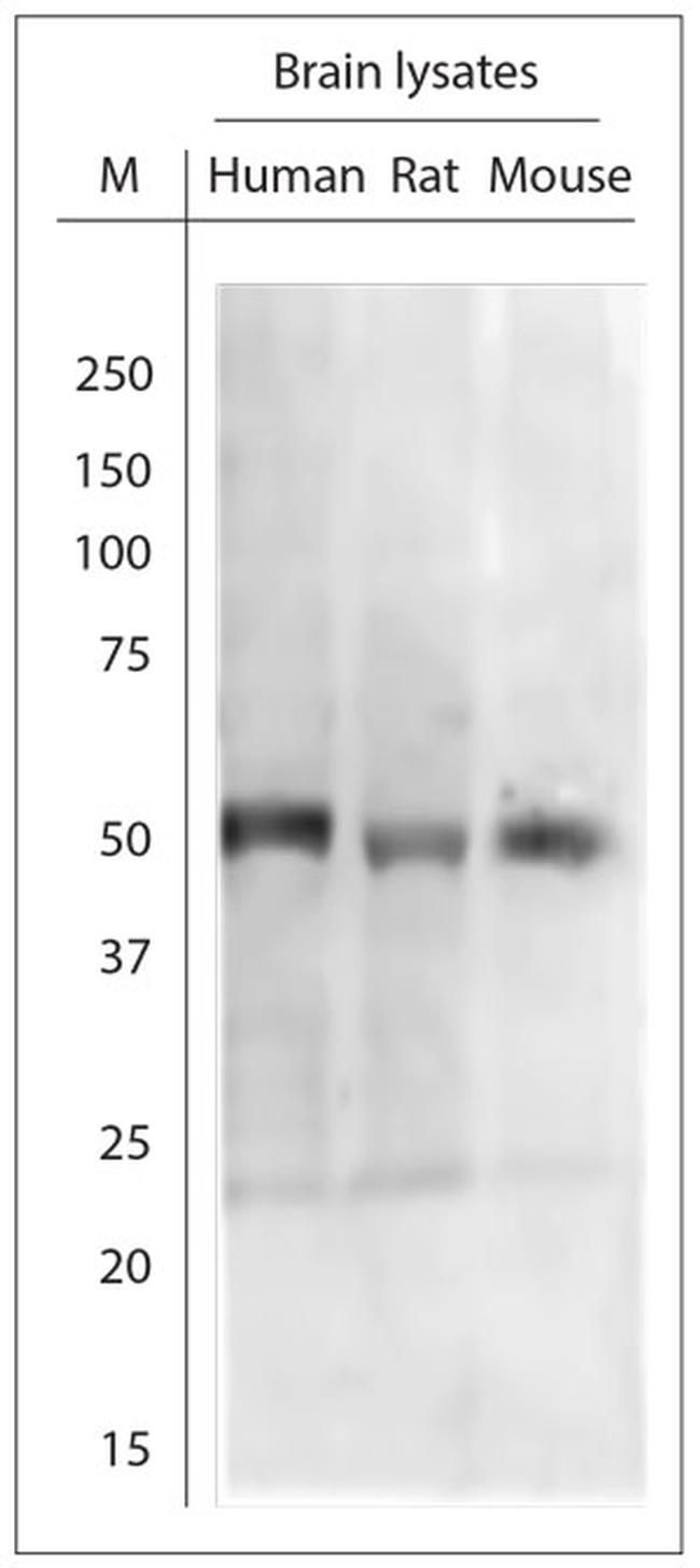 Tyrosine Hydroxylase Antibody in Western Blot (WB)