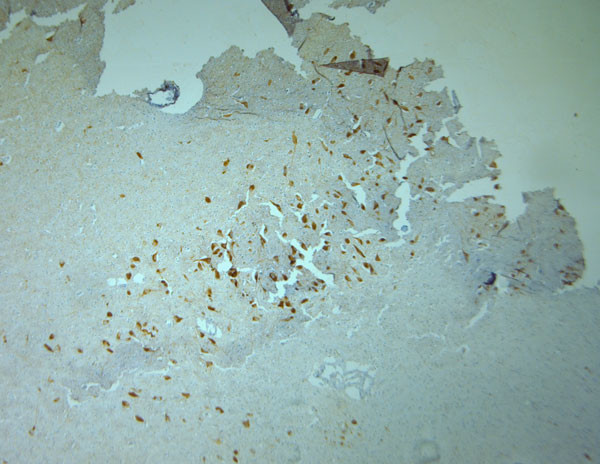 Tyrosine Hydroxylase Antibody in Immunohistochemistry (Paraffin) (IHC (P))