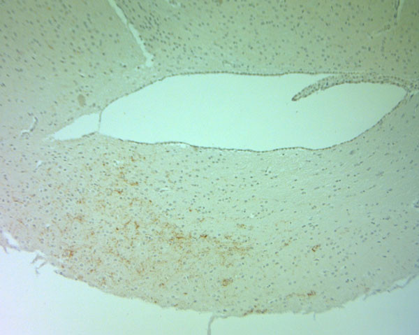 Tyrosine Hydroxylase Antibody in Immunohistochemistry (Paraffin) (IHC (P))