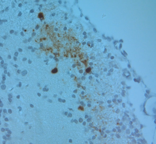 Tyrosine Hydroxylase Antibody in Immunohistochemistry (Paraffin) (IHC (P))