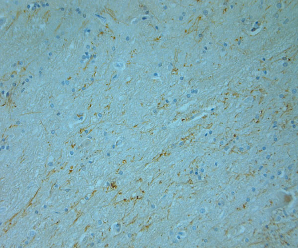 Tyrosine Hydroxylase Antibody in Immunohistochemistry (Paraffin) (IHC (P))