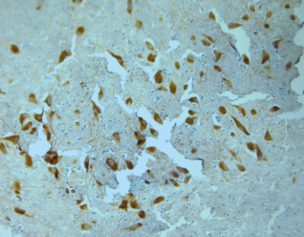 Tyrosine Hydroxylase Antibody in Immunohistochemistry (Paraffin) (IHC (P))