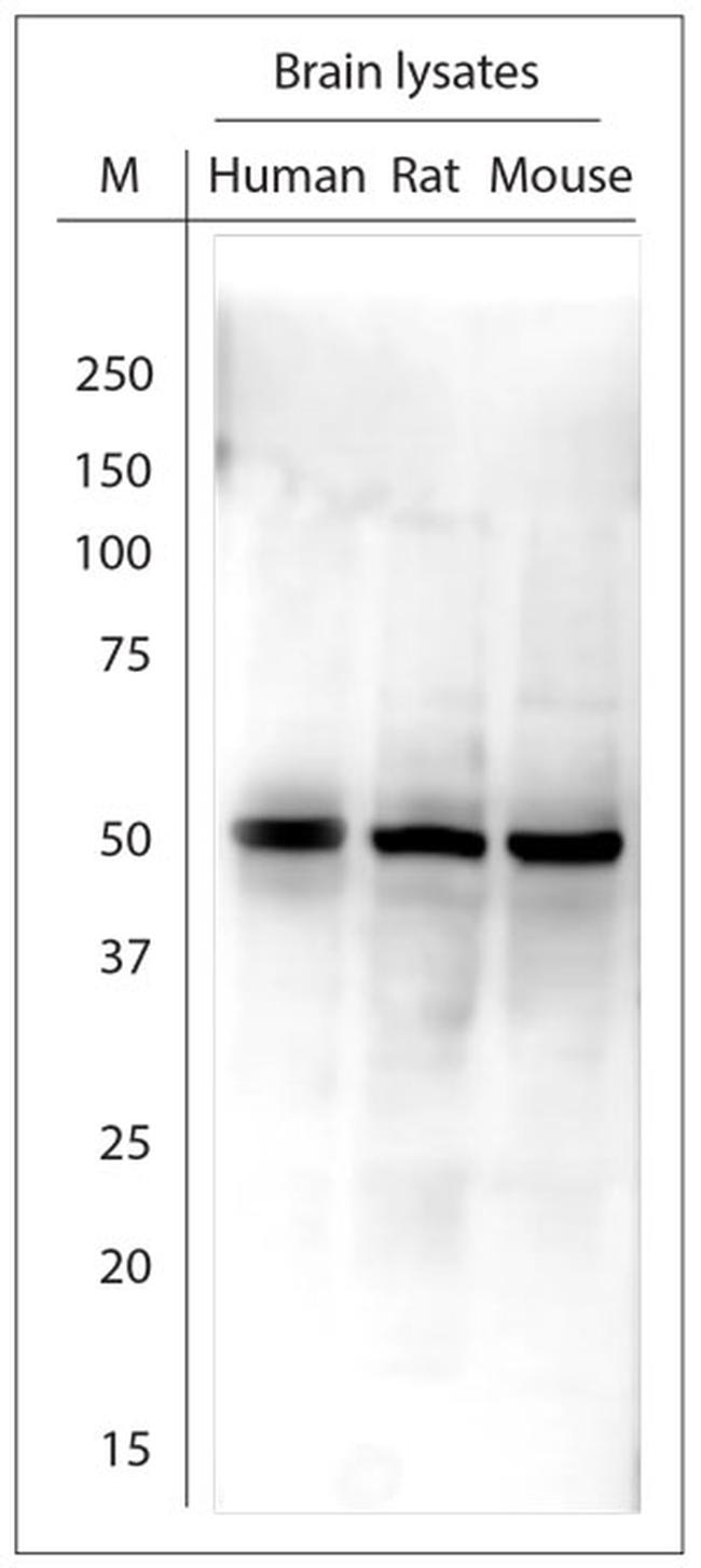 Tyrosine Hydroxylase Antibody in Western Blot (WB)