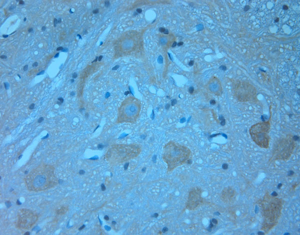 TRIM32 Antibody in Immunohistochemistry (Paraffin) (IHC (P))