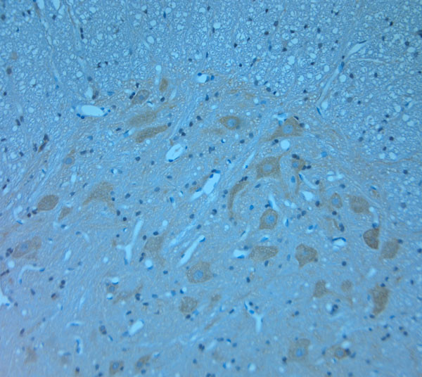 TRIM32 Antibody in Immunohistochemistry (Paraffin) (IHC (P))