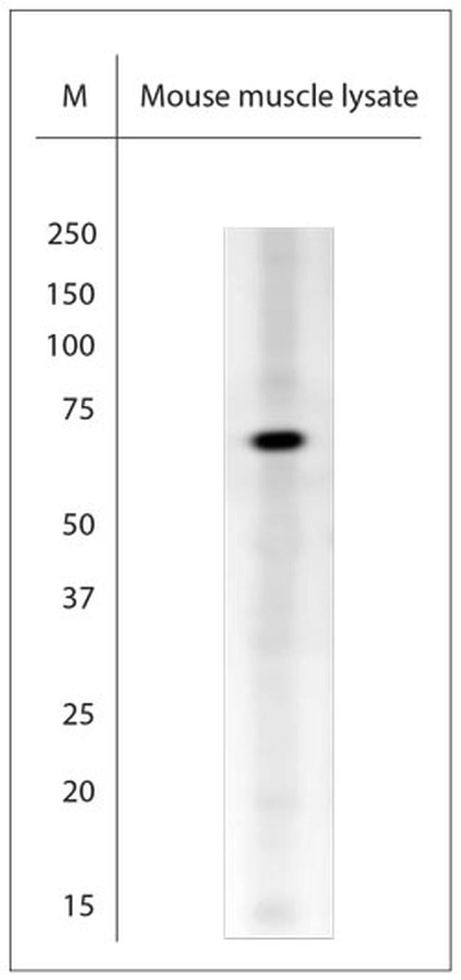 TRIM32 Antibody in Western Blot (WB)