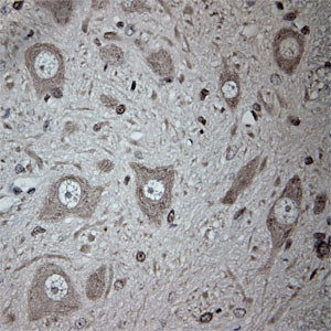 Tubulin beta Antibody in Immunohistochemistry (Paraffin) (IHC (P))