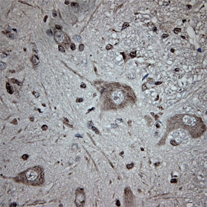 Tubulin beta Antibody in Immunohistochemistry (Paraffin) (IHC (P))