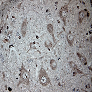 Tubulin beta Antibody in Immunohistochemistry (Paraffin) (IHC (P))