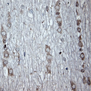 Tubulin beta Antibody in Immunohistochemistry (Paraffin) (IHC (P))