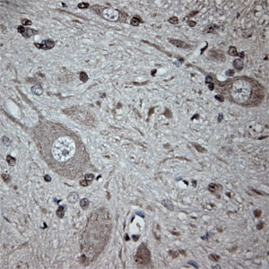 Tubulin beta Antibody in Immunohistochemistry (Paraffin) (IHC (P))