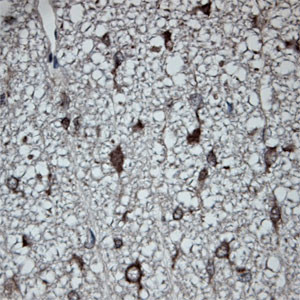 Tubulin beta Antibody in Immunohistochemistry (Paraffin) (IHC (P))