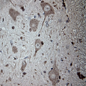 Tubulin beta Antibody in Immunohistochemistry (Paraffin) (IHC (P))