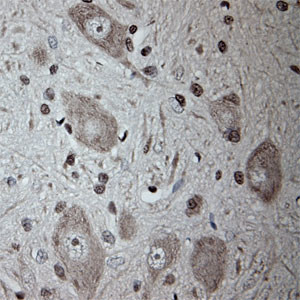 Tubulin beta Antibody in Immunohistochemistry (Paraffin) (IHC (P))