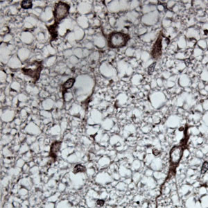 Tubulin beta Antibody in Immunohistochemistry (Paraffin) (IHC (P))