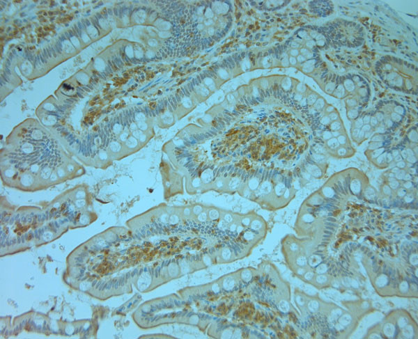 TANK Antibody in Immunohistochemistry (Paraffin) (IHC (P))